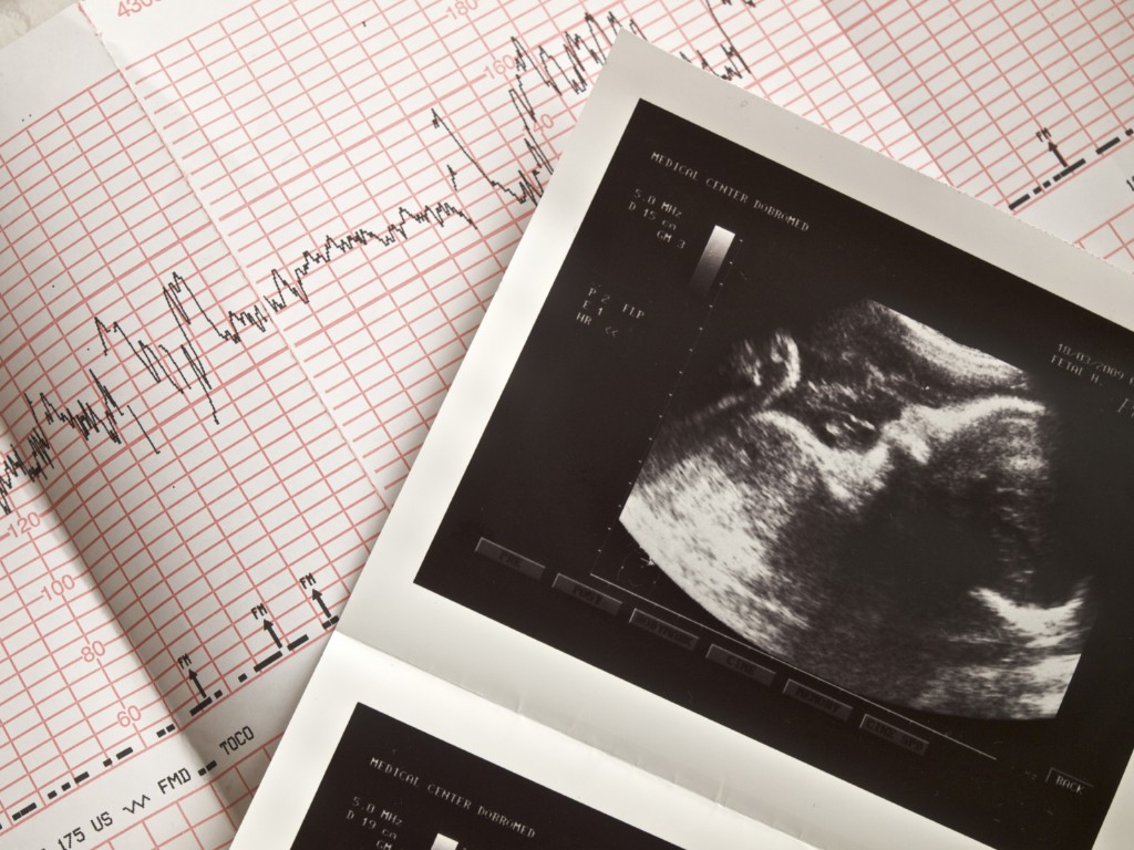 ultrasound shot and cardiogram of the unborn child