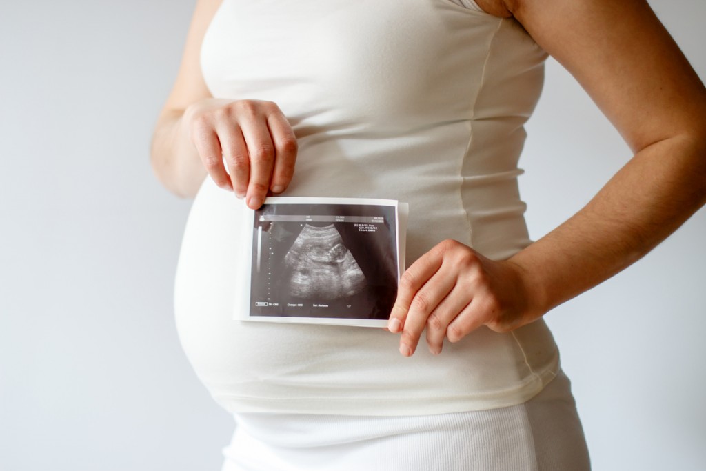 Pregnant woman with sonography report